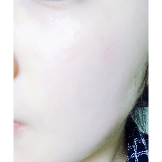 Nước Hoa Hồng Se Khít Lỗ Chân Lông SKINMISO PORE PURIFYING TONER_Mỹ phẩm Hàn Quốc chính hãng