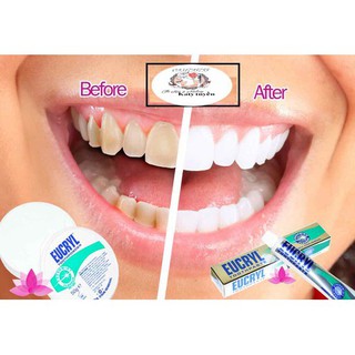 Bột trắng răng Eucryl 50g