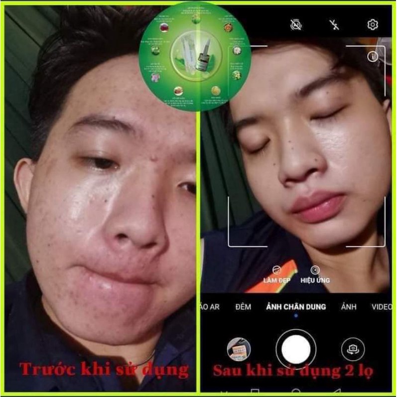 Serum thảo mộc xanh