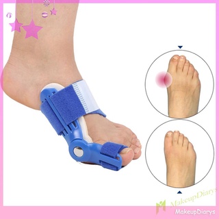 [Hàng mới về] Set 2 dụng cụ nẹp chỉnh hình ngón chân cái