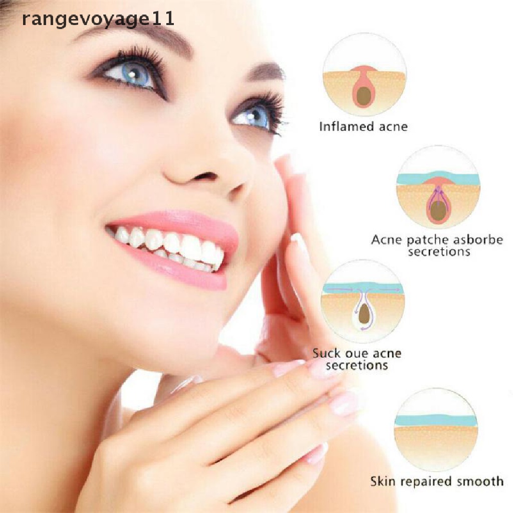 Bộ 36 Miếng Dán Mụn Hydrocolloid Và Mụn Trứng Cá Chăm Sóc Da