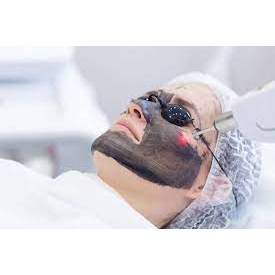 Than cacbon hoạt tính bắn trẻ hoá dùng cho laser [tuýp 80g]