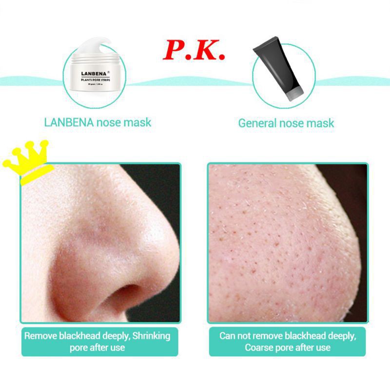 Gel dán lột mụn đầu đen LANBENA