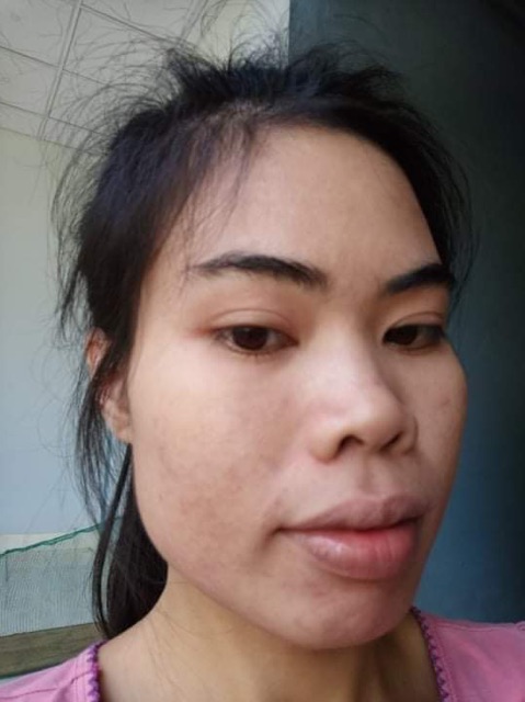 SERUM THANH DƯỢC - LÁRE( MẪU MỚI ) ĐIỀU TRỊ DA TỪ THIÊN NHIÊN | BigBuy360 - bigbuy360.vn