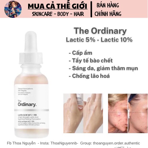 The Ordinary Tẩy Da Chết Mụn Đầu Đen Tinh Chất Lactic Acid