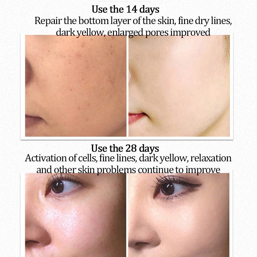 Tinh Chất Protein Cừu 5ml Dưỡng Ẩm Hydrat Hóa Làm Sáng Da Mặt | BigBuy360 - bigbuy360.vn