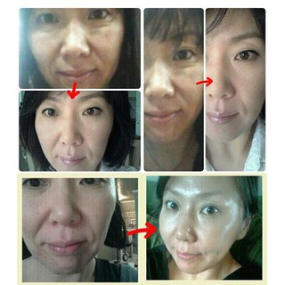 (Bill) Tinh Chất Vi Kim DR. TISHA T2 SERUM