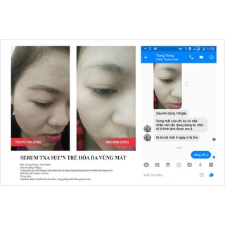 Tinh chất Trẻ hóa da vùng mắt