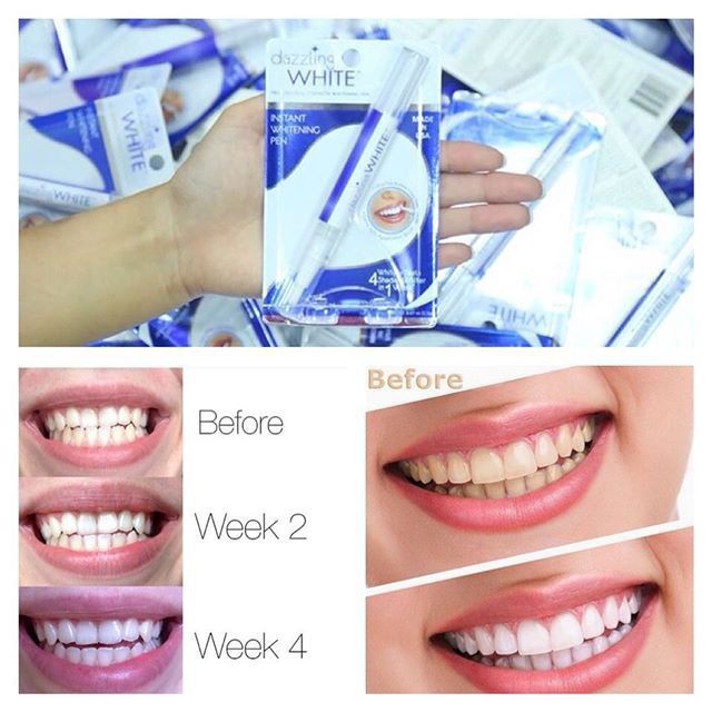 [Sỉ-Rẻ] Bút làm trắng răng Dazzling White – SVN [Lẻ-Sỉ]