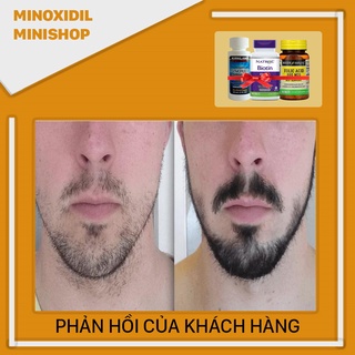 Combo Mọc Râu Tóc Minoxidil Lỏng + Biotin + Folic (Tặng LCLT)