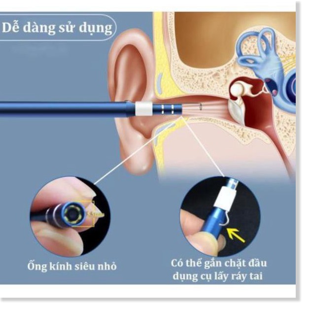 Dụng Cụ Lấy Ráy Tai Có Camera KAW Nội Soi Tai Mũi Họng 3 Trong 1 App Kết Nối Với Điện Thoại full HD