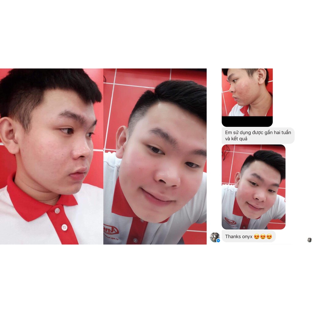 KEM DƯỠNG KHÓA ẨM TRẮNG DA ONYX | BigBuy360 - bigbuy360.vn