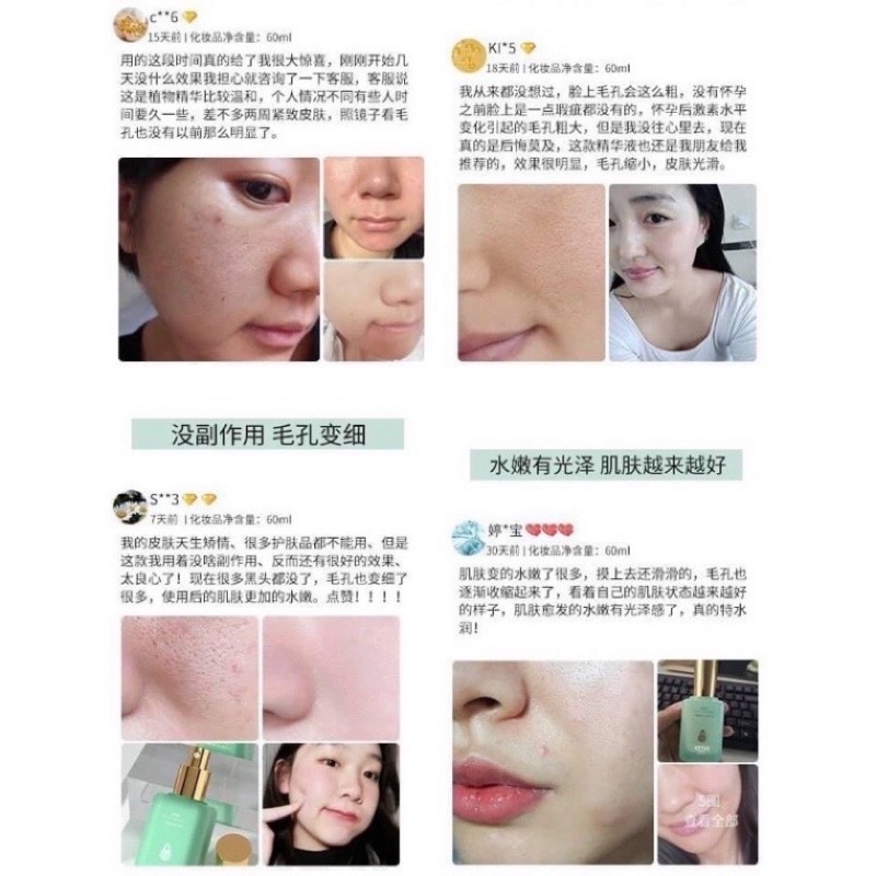 Serum Thoa Nhỏ Lỗ Chân Lông