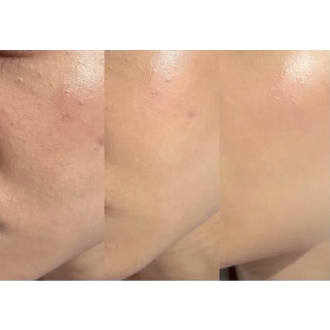 Serum Estee Lauder Advanced Night Repair Chính Hãng