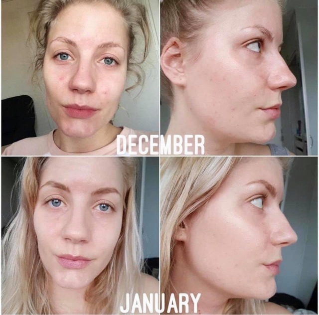 Serum chống lão hoá The Buffet mẫu mới