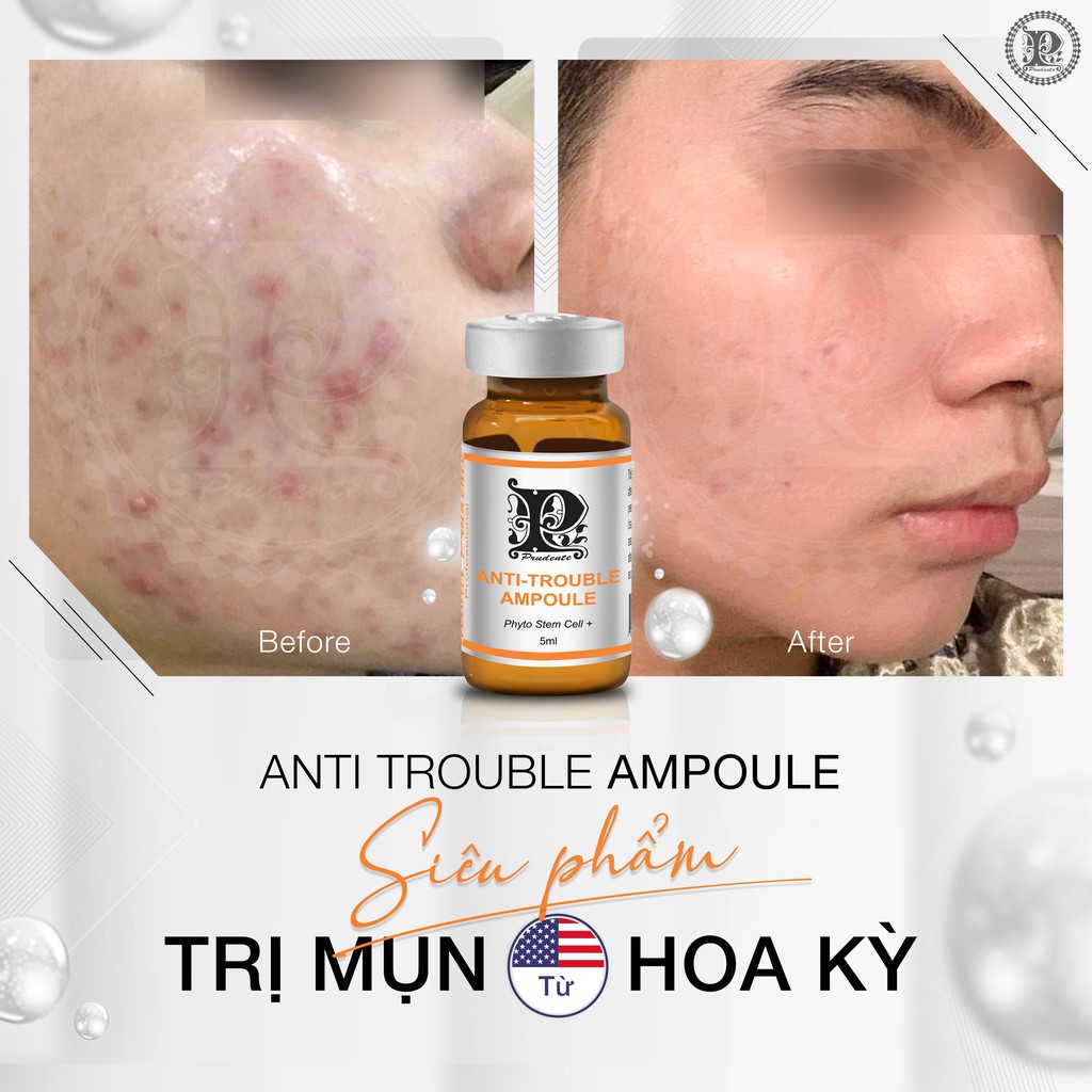 Tinh Chất Giảm Mụn Anti Trouble Ampoule Nuwhite Mibiti Prudente Professional