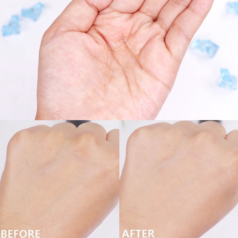 Toner Some By Mi Giảm Mụn Dịu Da Cho Da Dầu Mụn AHA-BHA-PHA 30 Days Miracle 150ml - Khongcoson