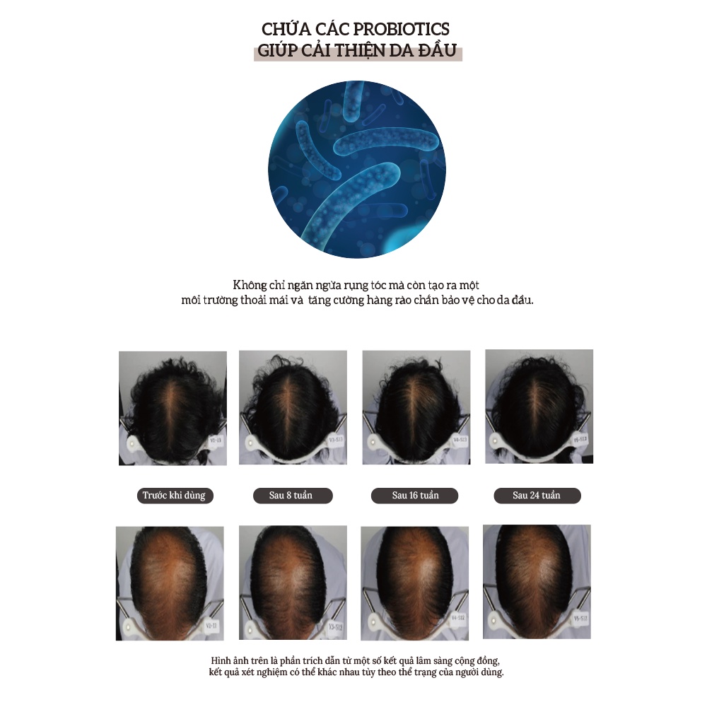 Dầu gội Dr.Smart Sakura giúp giảm gãy rụng, biotin collagen 300ml