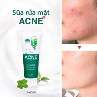 Sữa rửa mặt ACNE Naomi