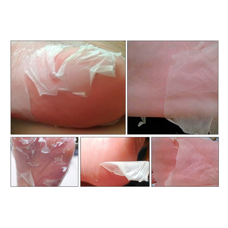 Mặt Nạ Lô Hội Dạng Lột Tẩy Tế Bào Chết Chống Nứt Nẻ Cho Bàn Chân