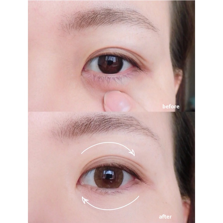 Rnw set Kem Dưỡng Da Mắt 20g Giúp Loại Bỏ Quầng Thâm Và Nếp Nhăn Hiệu Quả