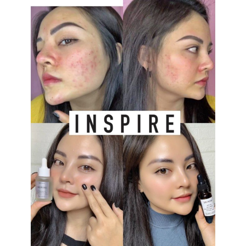 Serum Tinh Chất Căng Bóng Da Inspire (Kèm quà tặng)