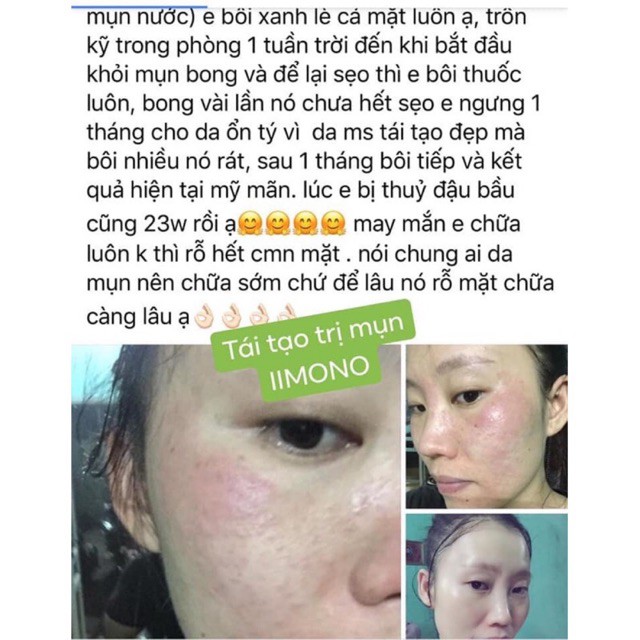 Combo 3 hộp tinh chất mụn IIMONO 6ml | BigBuy360 - bigbuy360.vn