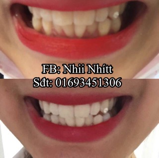 Miếng dán trắng răng Crest Supreme Professional Whitening Strips 7days