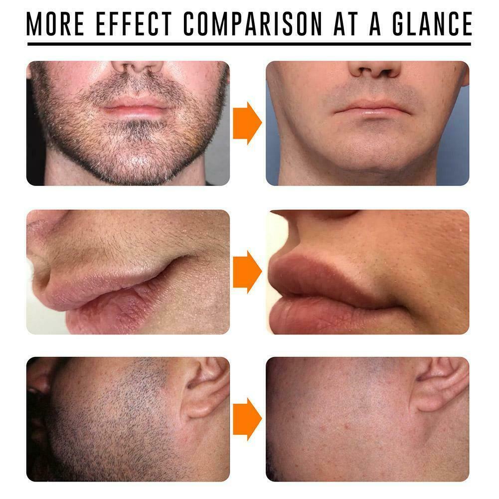 Kem Tẩy Lông Râu T4I4 10 / 20 / 30 / 50g Dành Cho Nam Giới