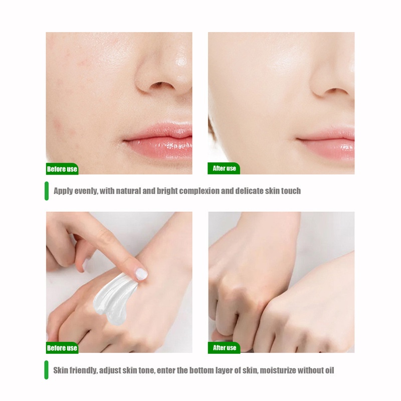 Kem Dưỡng Trắng Da 10/20/30/50ML Dưỡng Ẩm Cải Thiện Melanin Cải Thiện Melanin Chăm Sóc Da Toàn Thân