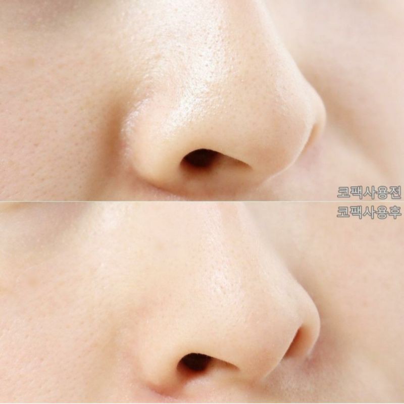 Dán lột mụn mũi HATHERINE Pore Clear Nose Pack