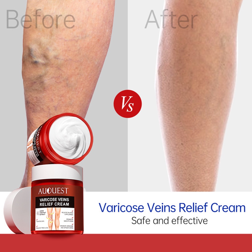 Kem Chiết Xuất Từ Gừng Tự Nhiên 80g Giúp Giảm Giãn Tĩnh Mạch Hiệu Quả