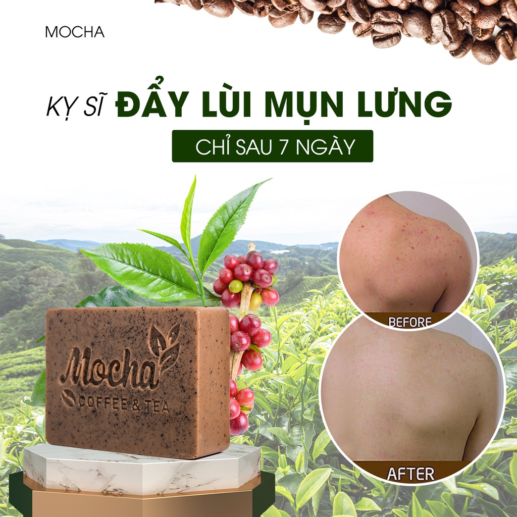 Xà Phòng Giảm Mụn Lưng Mocha Acne Body Soap, Đánh Bay Mụn Lưng, Láng Mịn Làn Da