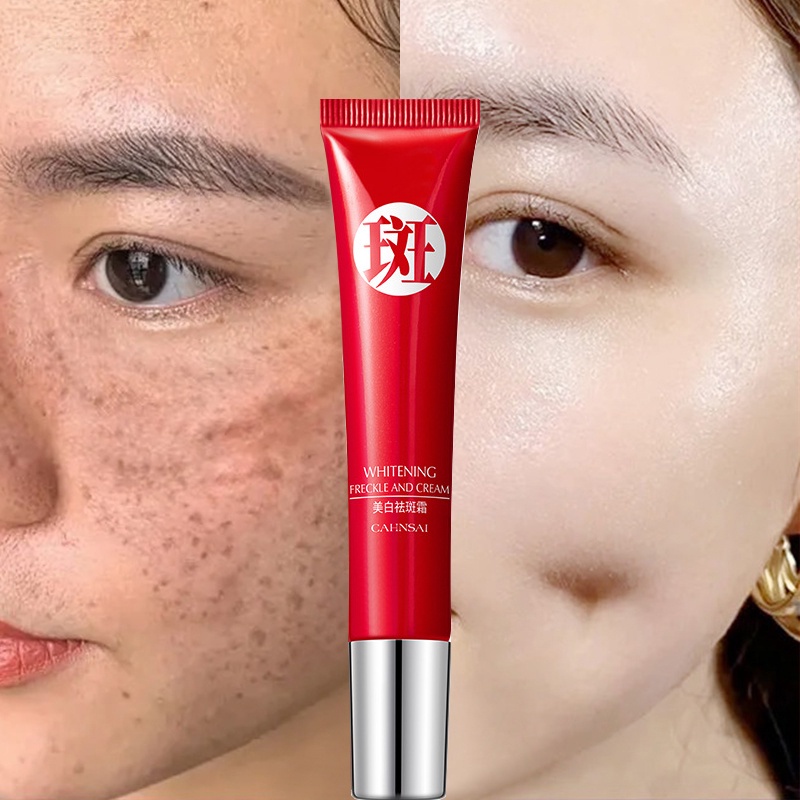 Kem Hỗ trợ giảm tàn nhang Làm Trắng Da Và Phục Hồi Làn Da 20g