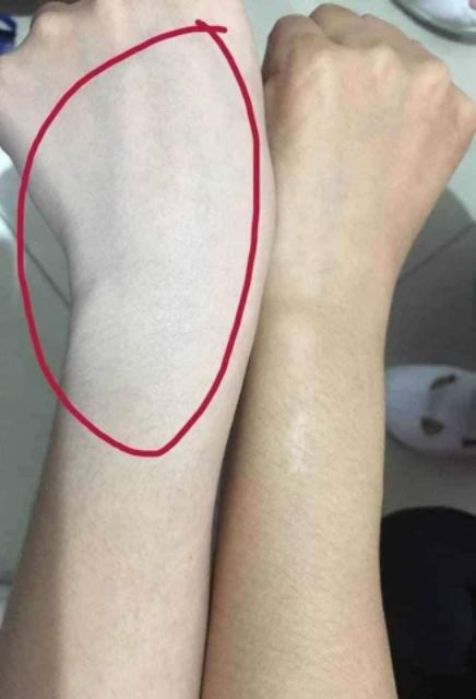 TRUYỀN TRẮNG NANO WHITE Chính Hãng