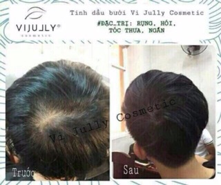 XỊT BƯỞI VYJULY