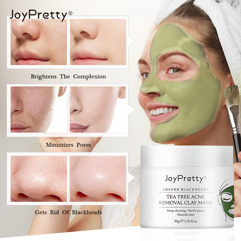 JoyPretty's Kem Trị Mụn Chiết Xuất Thảo Dược Làm Trắng Và Chăm Sóc Da Mặt 50g【Green】