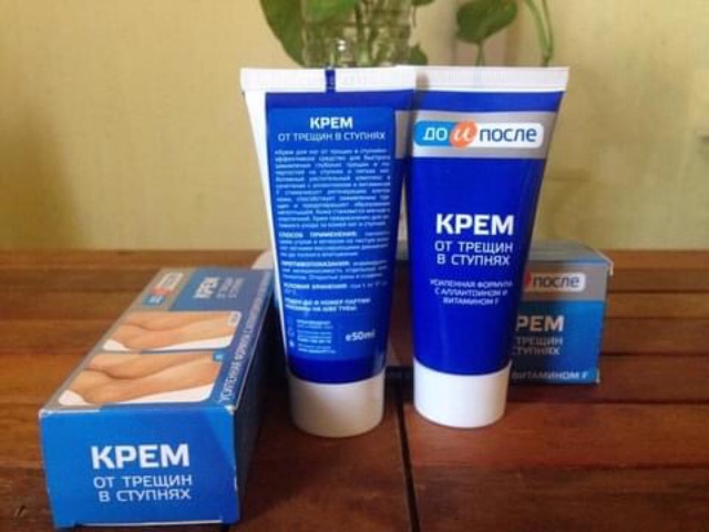 Kem nứt gót chân hàng nội địa Nga tuýp 50ml