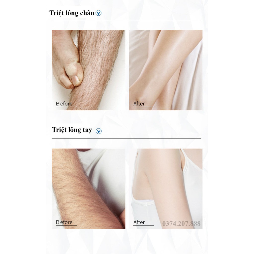 Xịt tẩy lông DETVFO Không Đau Lành Tính Dịu Nhẹ - Kem tẩy lông nách, tay, chân, lưng dạng xịt 150ml- LAZEN COSMETICS | BigBuy360 - bigbuy360.vn