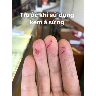 Kem dưỡng da đa năng Glysolid nội địa Đức