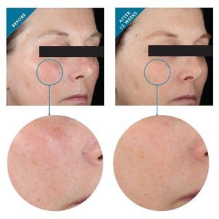 Serum Skinceuticals Hydrating B5 Minisize 4ml - 30ml