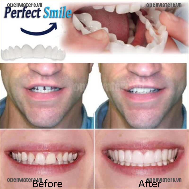 OPC 3X Cosmetic Dentistry Instant Perfect Smile Comfort Fit Flex Teeth Veneer