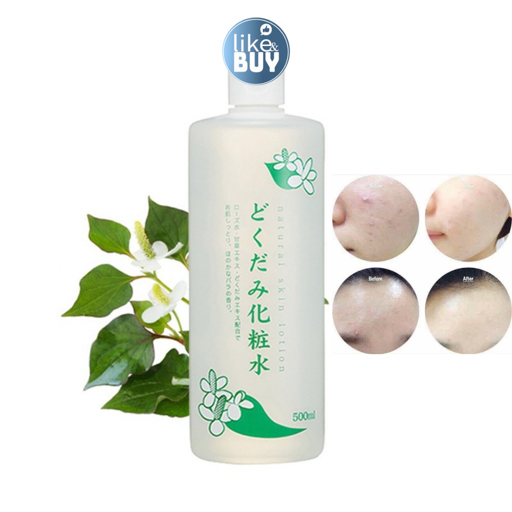 TONER RAU DIẾP CÁ SẠCH KHUẨN, NGỪA MỤN, SE KHÍT CHÂN LÔNG, THANH LỌC THẢI ĐỘC DA DOKUDAMI NATURAL SKIN LOTION - NHẬT BẢN | BigBuy360 - bigbuy360.vn