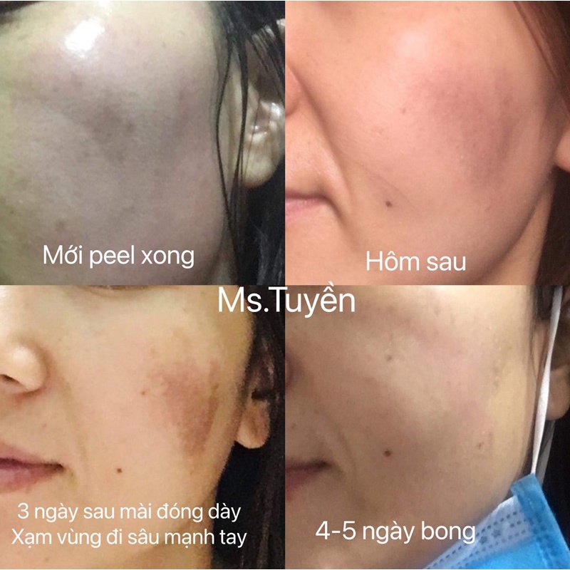 vi tảo sinh học set lẻ | BigBuy360 - bigbuy360.vn