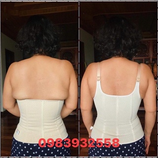 Gen latex giảm mỡ lưng và bụng