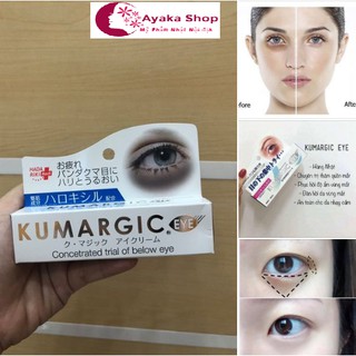 Kem Ngăn Ngừa Thâm Quầng Mắt Kumargic eye Nhật Bản -  Mỹ Phẩm Nhật Nôi Địa AyakaShop.