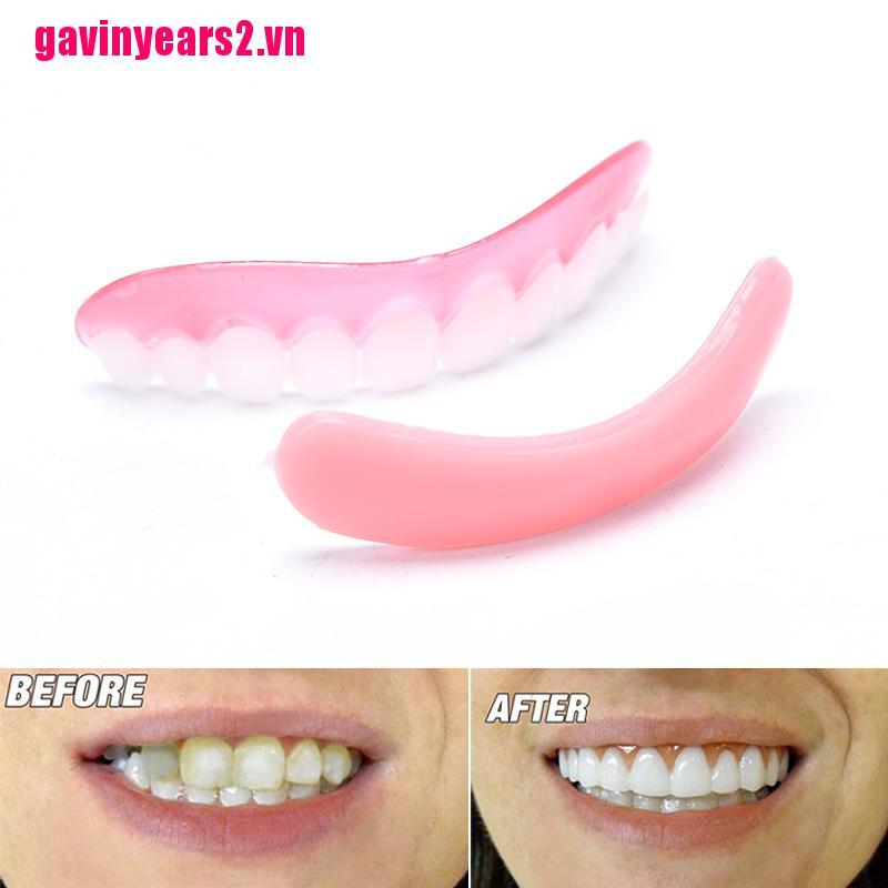 Răng Giả Trên Gav2 Màu Trắng Hoàn Hảo