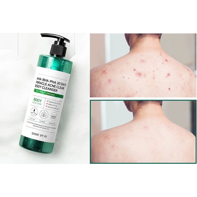 Sữa tắm Some by mi AHA-BHA-PHA 30 Days Miracle Acne Clear Body Cleanser 400ml