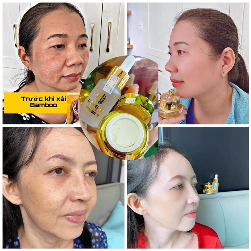 Combo kem face lụa bamboo+serum tái sinh da Mẫu mới 8- 2023
