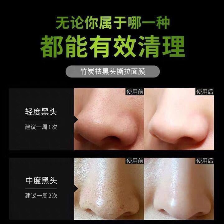 Mặt nạ than tre lột mụn đầu đen se khít lỗ chân lông | BigBuy360 - bigbuy360.vn